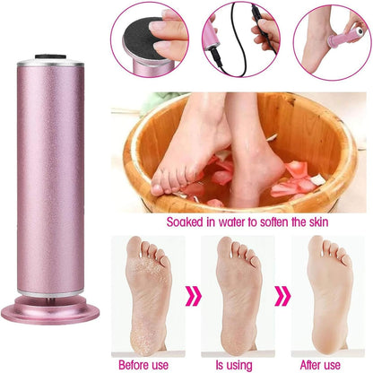 Electric Callus Remover